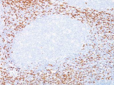 CD8 Monoclonal Mouse Antibody (C8/468 + C8/144B)