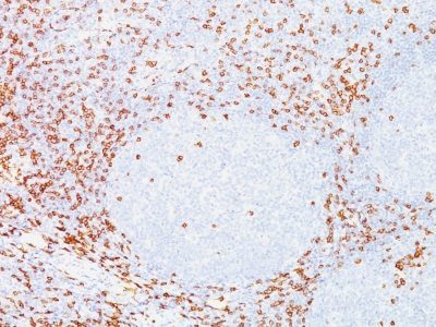 CD8 Monoclonal Mouse Antibody (C8/468)