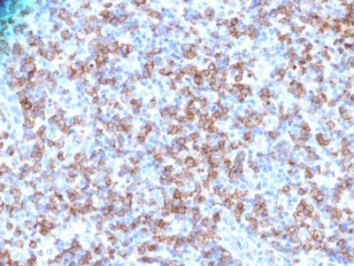 CD8A Polyclonal Rabbit Antibody (N/A)