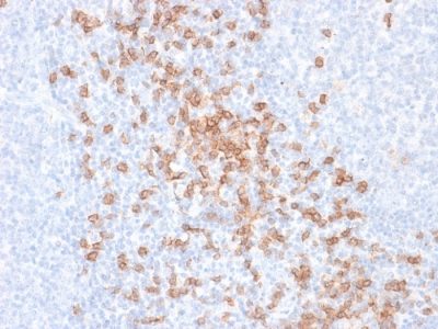 CD8A Recombinant Monoclonal Mouse Antibody (rC8/468)