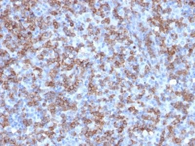 CD8A Recombinant Monoclonal Rabbit Antibody (C8/1779R)