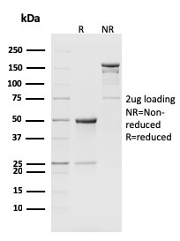 CD8b (Mouse) Monoclonal Rat Antibody (H35-17.2)