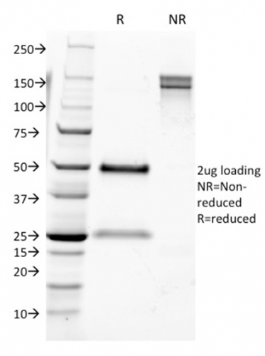 CD9 Monoclonal Mouse Antibody (CD9/1631)