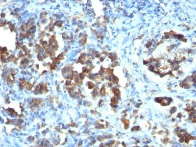 Cdc20 Monoclonal Mouse Antibody (CDC20/1102)