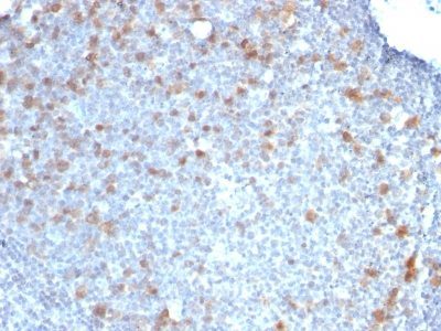 Cdc20 Monoclonal Mouse Antibody (CDC20/1102)