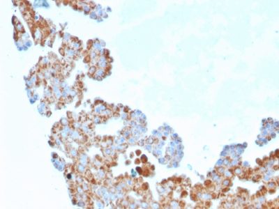 Cdc34 homolog Monoclonal Mouse Antibody (CPTC-CDC34-2)