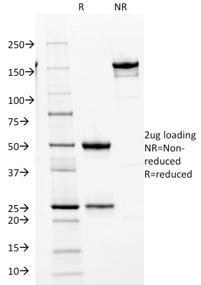Cdk2 / p34cdc2 Serine-Threonine Kinase Monoclonal Mouse Antibody (AN4.3)
