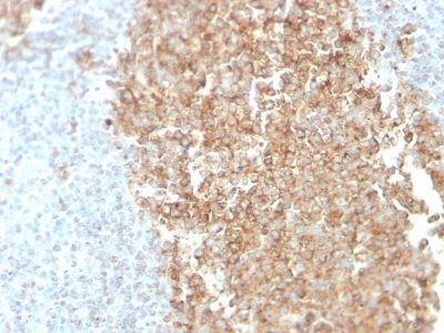 CDw75 Monoclonal Mouse Antibody (ZB55)