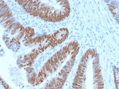 CDX2 / Caudal Type Homeobox 2 Recombinant Monoclonal Rabbit Antibody (CDX2/2951R)