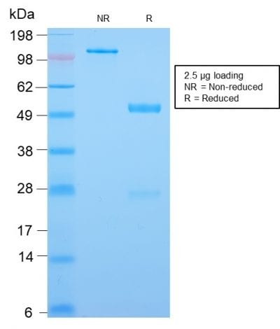CDX2 / Caudal Type Homeobox 2 Recombinant Monoclonal Rabbit Antibody (CDX2/2951R)