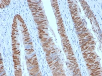 CDX2 / Caudal Type Homeobox 2 Recombinant Monoclonal Rabbit Antibody (CDX2/2951R)