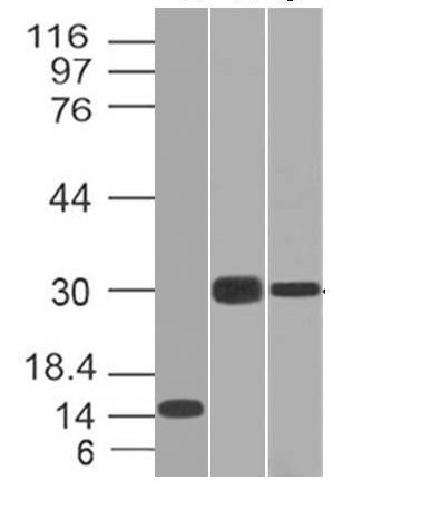 CELA3B / ELA3B Monoclonal Mouse Antibody (CELA3B/1218)