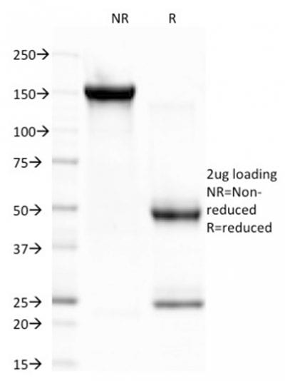 CELA3B / ELA3B Monoclonal Mouse Antibody (CELA3B/1757)