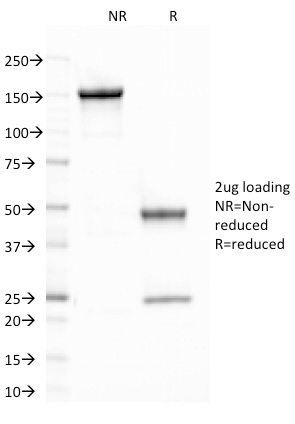 CELA3B / ELA3B Monoclonal Mouse Antibody (CELA3B/1758)