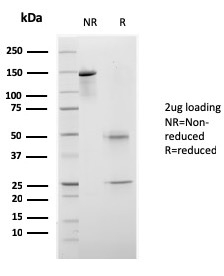 CELA3B / ELA3B Recombinant Monoclonal Mouse Antibody (rCELA3B/1811)