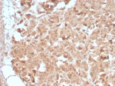 CELA3B / ELA3B Recombinant Monoclonal Rabbit Antibody (CELA3B/2809R)