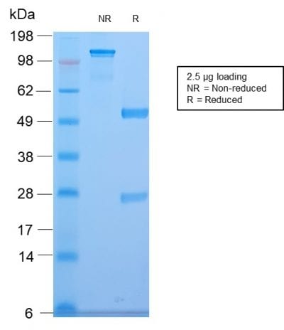 CELA3B / ELA3B Recombinant Monoclonal Rabbit Antibody (CELA3B/2810R)