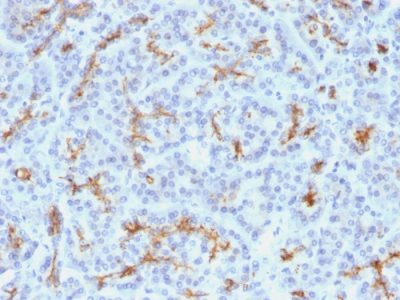 CFTR Monoclonal Mouse Antibody (M3A7)