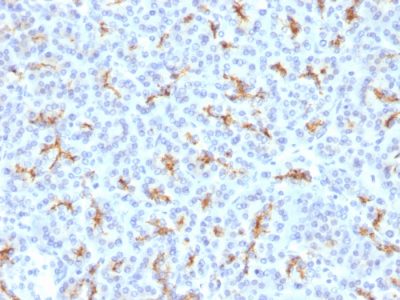 CFTR Polyclonal Rabbit Antibody (N/A)