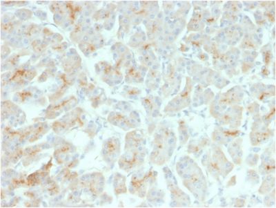 CFTR Recombinant Monoclonal Mouse Antibody (rCFTR/1342)