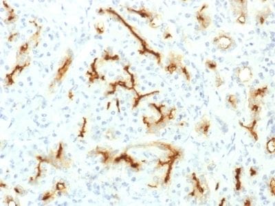 CFTR Recombinant Monoclonal Rabbit Antibody (CFTR/1775R)