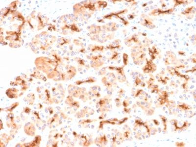 CFTR Recombinant Monoclonal Rabbit Antibody (CFTR/2290R)