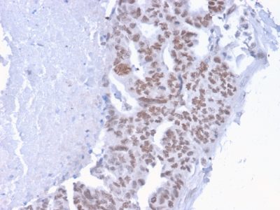 CHD4 Monoclonal Mouse Antibody (3F2/4)