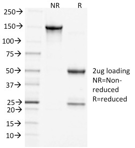 Clathrin, Heavy Chain Monoclonal Mouse Antibody (CHC/1432)