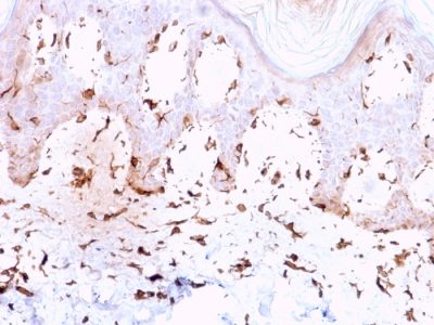 Collagen VII Monoclonal Mouse Antibody (LH7.2)