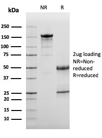 Complement 3d Monoclonal Mouse Antibody (C3D/2891)