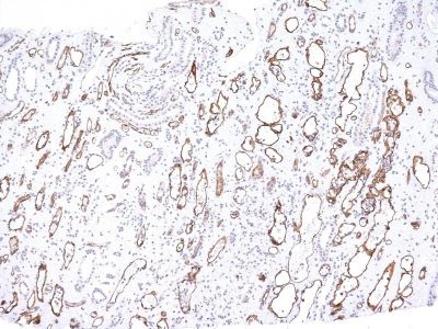 Complement C4d Monoclonal Mouse Antibody (C4D204)