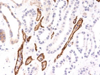 Complement C4d Monoclonal Mouse Antibody (C4D204)