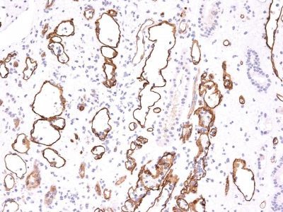 Complement C4d Monoclonal Mouse Antibody (C4D204)