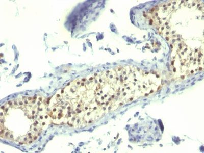 Complement C4d Monoclonal Mouse Antibody (C4D205)
