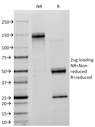 Creatine Kinase B Monoclonal Mouse Antibody (CKBB/1268)