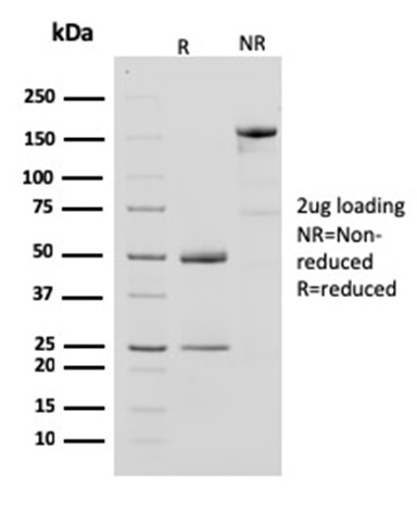 Creatine Kinase B Monoclonal Mouse Antibody (CPTC-CKB-2)
