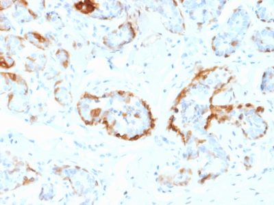 Crystallin Alpha B Monoclonal Mouse Antibody (CPTC-CRYAB-1)