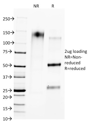 CTLA4 / CD152 Monoclonal Mouse Antibody (L4P2F5.F10)