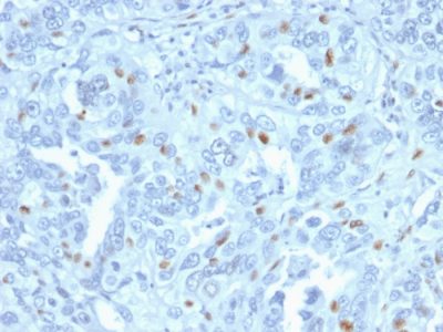 Cyclin A2 Monoclonal Mouse Antibody (CCNA2/2333)