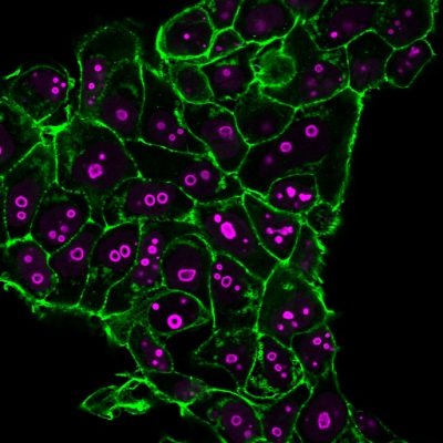 Cyclin B1 Monoclonal Mouse Antibody (CCNB1/1098)