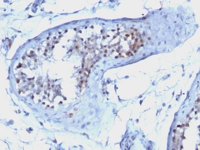 Cyclin B1 Monoclonal Mouse Antibody (CCNB1/1098)