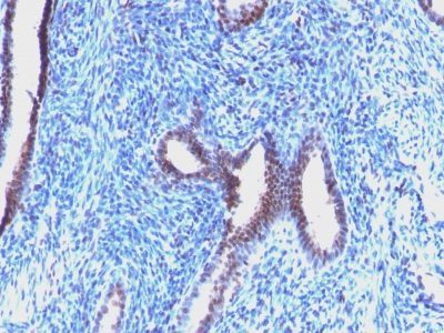 Cyclin B1 Monoclonal Mouse Antibody (CCNB1/1098)