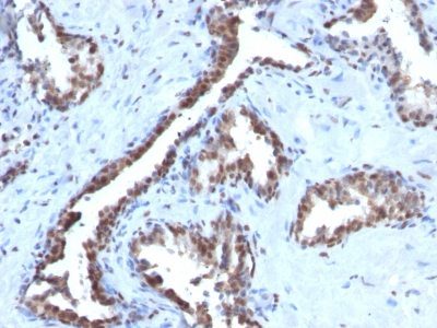 Cyclin B1 Monoclonal Mouse Antibody (CCNB1/1098)