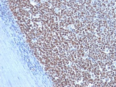 Cyclin B1 Monoclonal Mouse Antibody (CCNB1/1098)