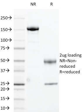 Cyclin B1 Monoclonal Mouse Antibody (CCNB1/1098)