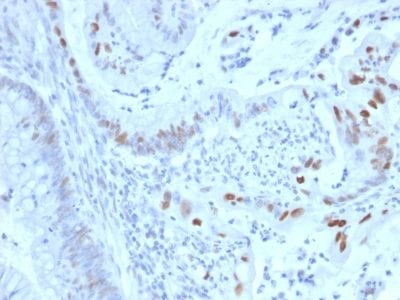 Cyclin E Monoclonal Mouse Antibody (CCNE1/2460)
