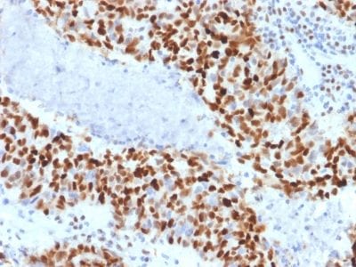 Cyclin E Monoclonal Mouse Antibody (CCNE1/2460)