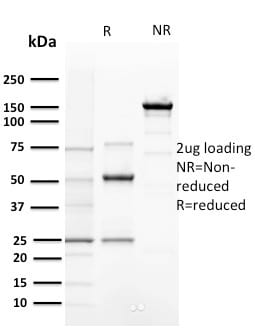 Cyclin E Monoclonal Mouse Antibody (CCNE1/2460)