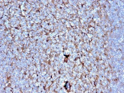 Cystatin A Monoclonal Mouse Antibody (CSTA/2882)