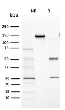 Cytochrome P450 1A1/1A2 Monoclonal Mouse Antibody (MC1)